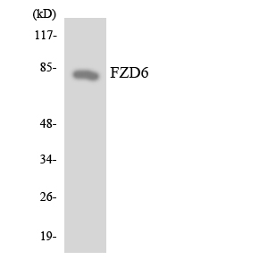FZD6 / Frizzled 6 Antibody - Western blot analysis of the lysates from 293 cells using FZD6 antibody.
