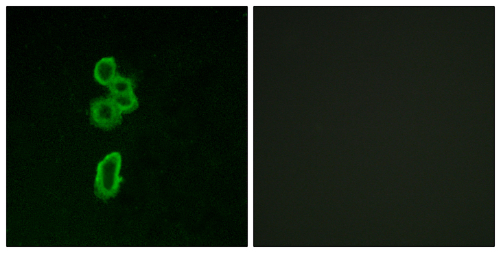 FZD6 / Frizzled 6 Antibody - Immunofluorescence analysis of MCF7 cells, using FZD6 Antibody. The picture on the right is blocked with the synthesized peptide.