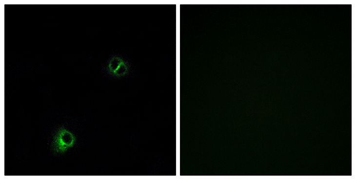 FZD9 / Frizzled 9 Antibody - Immunofluorescence analysis of A549 cells, using FZD9 Antibody. The picture on the right is blocked with the synthesized peptide.