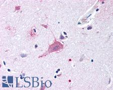 FZD9 / Frizzled 9 Antibody - Anti-FZD9 / Frizzled 9 antibody IHC of human brain, neurons and glia. Immunohistochemistry of formalin-fixed, paraffin-embedded tissue after heat-induced antigen retrieval.