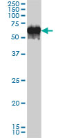 G3BP1 / G3BP Antibody - G3BP monoclonal antibody clone 2F3 Western blot of G3BP expression in A-431.