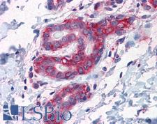 G3BP1 / G3BP Antibody - Anti-G3BP1 / G3BP antibody IHC of human breast. Immunohistochemistry of formalin-fixed, paraffin-embedded tissue after heat-induced antigen retrieval. Antibody concentration 5 ug/ml.