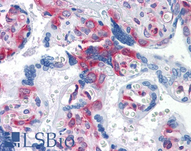 G3BP1 / G3BP Antibody - Anti-G3BP1 / G3BP antibody IHC of human placenta. Immunohistochemistry of formalin-fixed, paraffin-embedded tissue after heat-induced antigen retrieval. Antibody concentration 5 ug/ml.