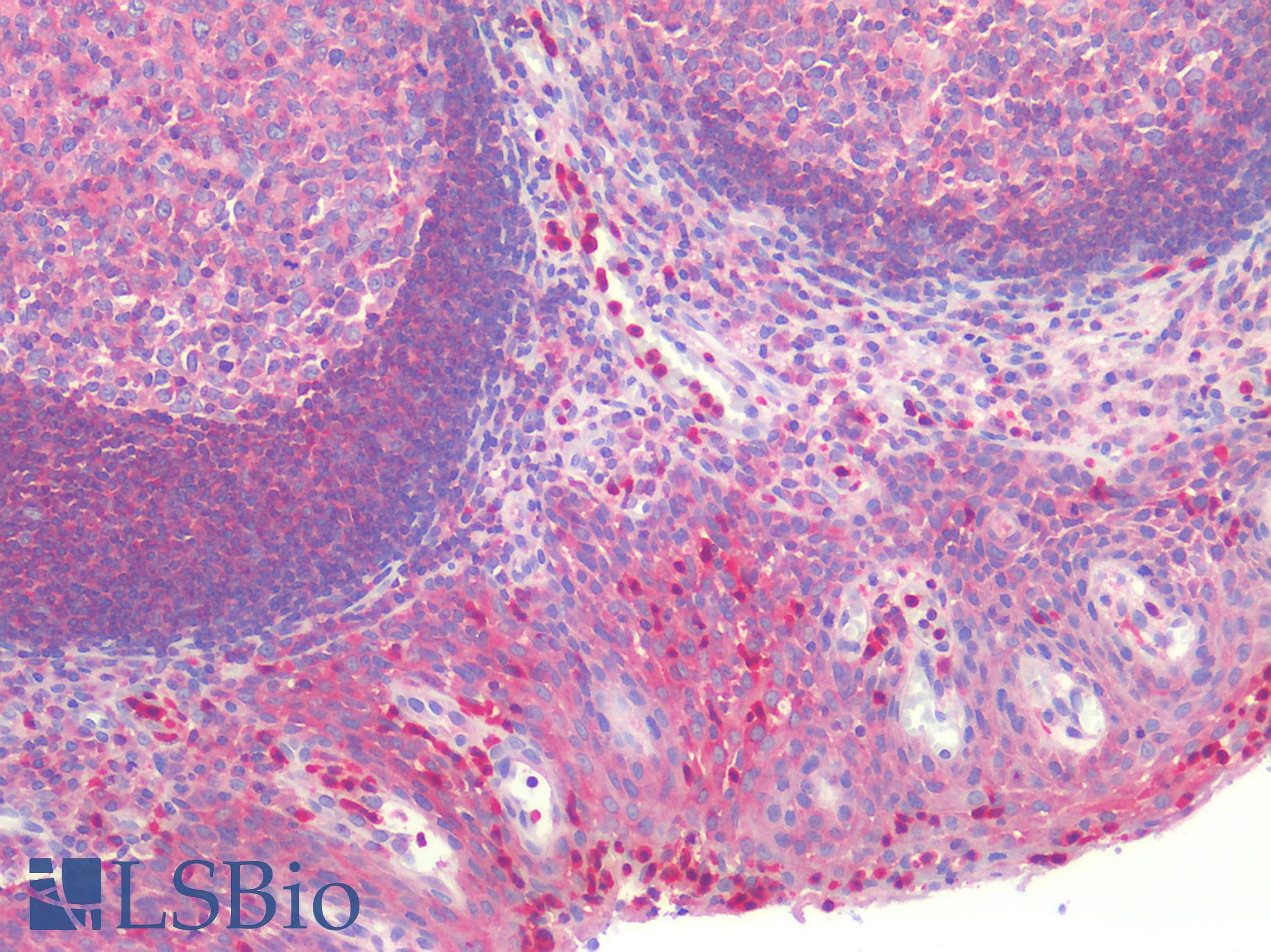 G6PD Antibody - Human Tonsil: Formalin-Fixed, Paraffin-Embedded (FFPE)