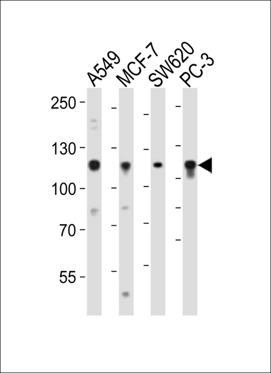 GAA / Alpha-Glucosidase, Acid Antibody - Western blot of lysates from A549, MCF-7, SW620, PC-3 cell line (from left to right), using GAA Antibody. Antibody was diluted at 1:1000 at each lane. A goat anti-rabbit IgG H&L (HRP) at 1:10000 dilution was used as the secondary antibody. Lysates at 20ug per lane.