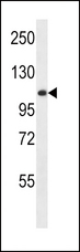 GAA / Alpha-Glucosidase, Acid Antibody - GAA Antibody western blot of HL-60 cell line lysates (35 ug/lane). The GAA antibody detected the GAA protein (arrow).