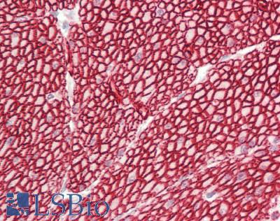 GAB2 Antibody - Human Small Intestine, Muscularis Propria: Formalin-Fixed, Paraffin-Embedded (FFPE)