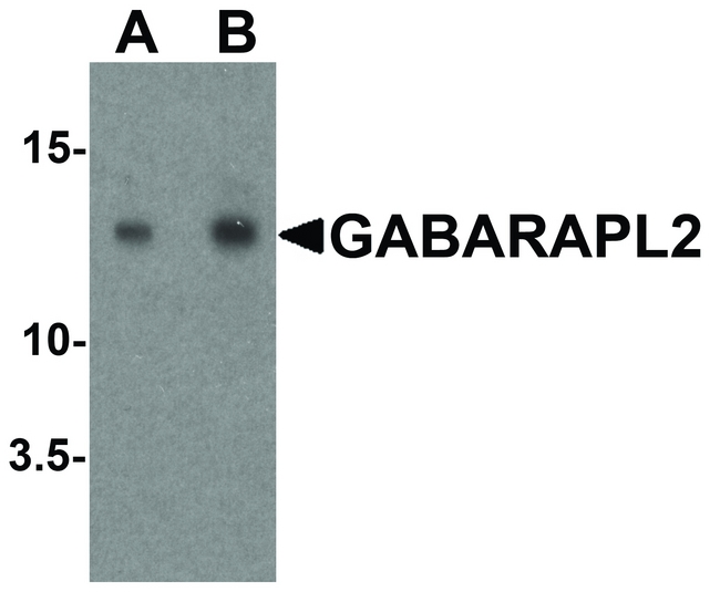 GABARAPL2 / ATG8 Antibody - Western blot analysis of GABARAPL2 in human brain tissue lysate with GABARAPL2 antibody at (A) 1 and (B) 2 ug/ml.