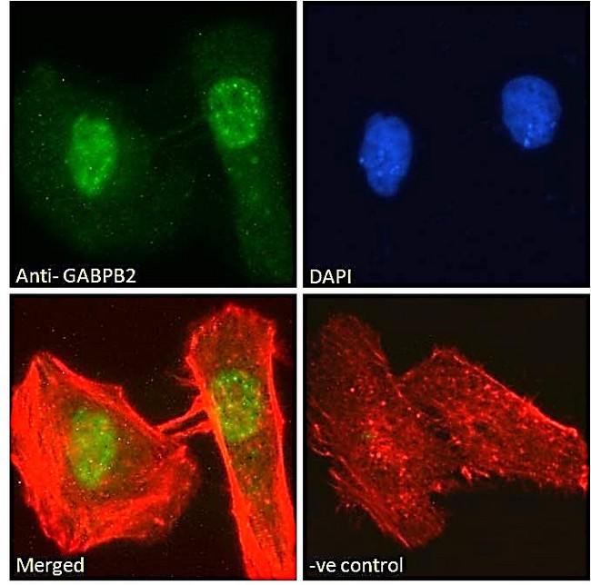 GABPB1 Antibody - Goat Anti-GABPB2 Antibody Immunofluorescence analysis of paraformaldehyde fixed HeLa cells, permeabilized with 0.15% Triton. Primary incubation 1hr (10ug/ml) followed by Alexa Fluor 488 secondary antibody (2ug/ml), showing nuclear/nuclear speckle staining. Actin filaments were stained with phalloidin (red) and the nuclear stain is DAPI (blue). Negative control: Unimmunized goat IgG (10ug/ml) followed by Alexa Fluor 488 secondary antibody (2ug/ml).