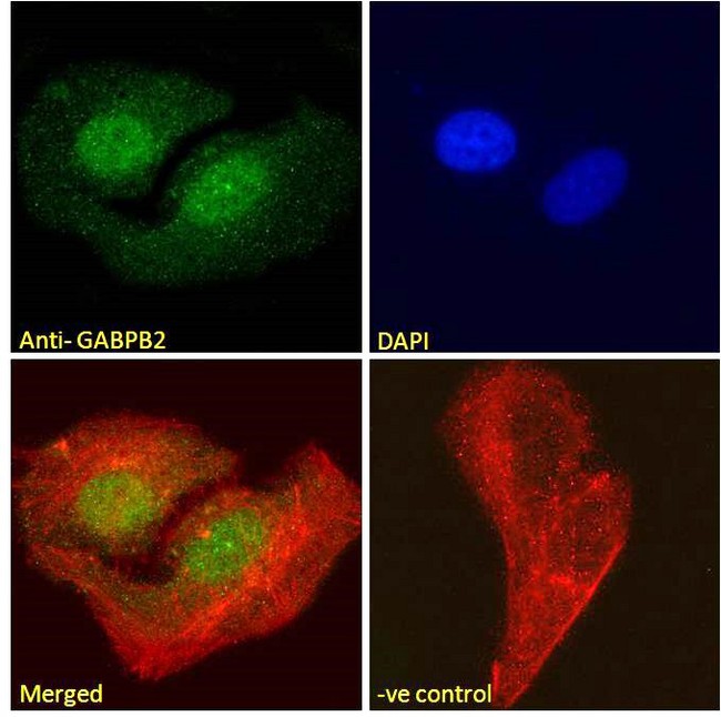 GABPB1 Antibody - Goat Anti-GABPB2 Antibody Immunofluorescence analysis of paraformaldehyde fixed U2OS cells, permeabilized with 0.15% Triton. Primary incubation 1hr (10ug/ml) followed by Alexa Fluor 488 secondary antibody (2ug/ml), showing nuclear staining. Actin filaments were stained with phalloidin (red) and the nuclear stain is DAPI (blue). Negative control: Unimmunized goat IgG (10ug/ml) followed by Alexa Fluor 488 secondary antibody (2ug/ml).