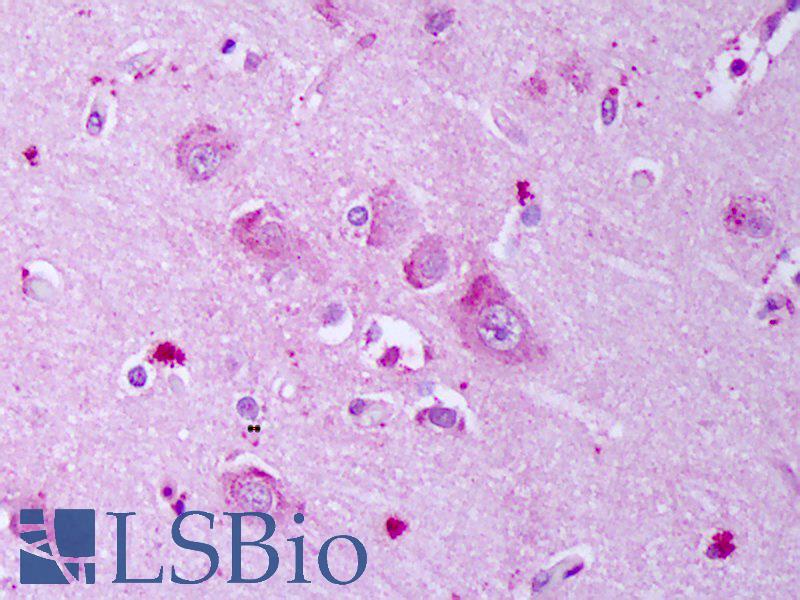 GABRA1 Antibody - Anti-GABRB1 antibody IHC of human brain, cortex neurons. Immunohistochemistry of formalin-fixed, paraffin-embedded tissue after heat-induced antigen retrieval. Antibody concentration 10 ug/ml.
