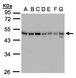 GABRB1 Antibody - Sample(30g whole cell lysate). A: 293T. B: A431. C: H1299. D: HeLa S3. E: Hep G2. F: MOLT4. G: Raji. 10% SDS PAGE. GABRB1 antibody diluted at 1:1000