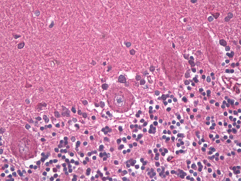 GABRB3 Antibody - Anti-GABRB3 antibody IHC staining of human brain, cerebellum, purkinje. Immunohistochemistry of formalin-fixed, paraffin-embedded tissue after heat-induced antigen retrieval.  This image was taken for the unconjugated form of this product. Other forms have not been tested.