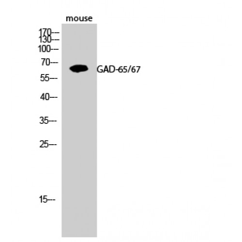 GAD 65+67 Antibody - Western blot of GAD-65/67 antibody