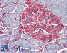 GAD 65+67 Antibody - Human Pancreas: Formalin-Fixed, Paraffin-Embedded (FFPE)