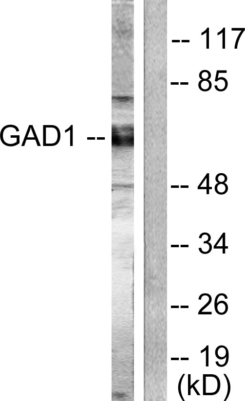 GAD / Glutamate Decarboxylase Antibody - Western blot analysis of lysates from mouse brain, using GAD1/2 Antibody. The lane on the right is blocked with the synthesized peptide.