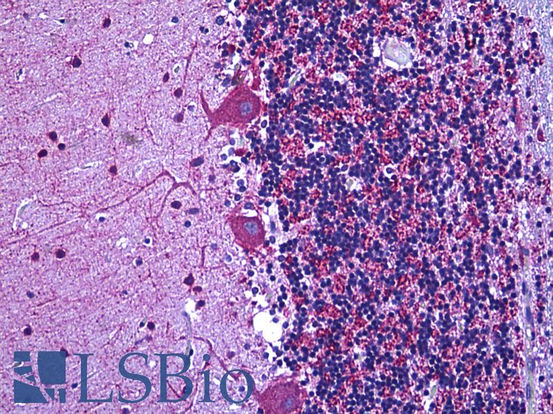 GAD / Glutamate Decarboxylase Antibody - Anti-Glutamate Decarboxylase antibody IHC of human brain cerebellum. Immunohistochemistry of formalin-fixed, paraffin-embedded tissue after heat-induced antigen retrieval. Antibody dilution 1:100.