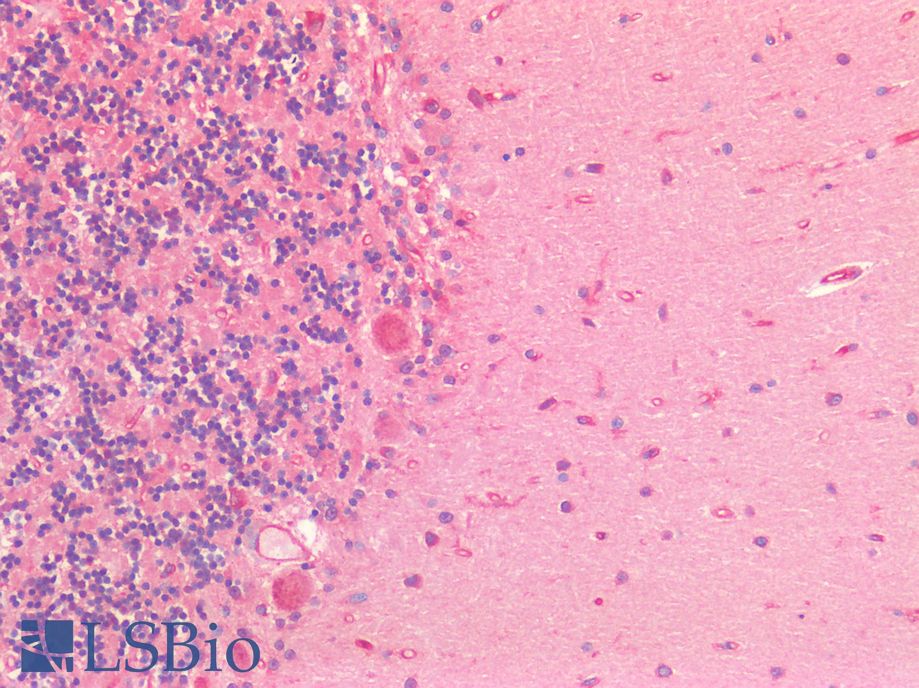 GAD1 / GAD67 Antibody - Human Brain, Cerebellum: Formalin-Fixed, Paraffin-Embedded (FFPE)