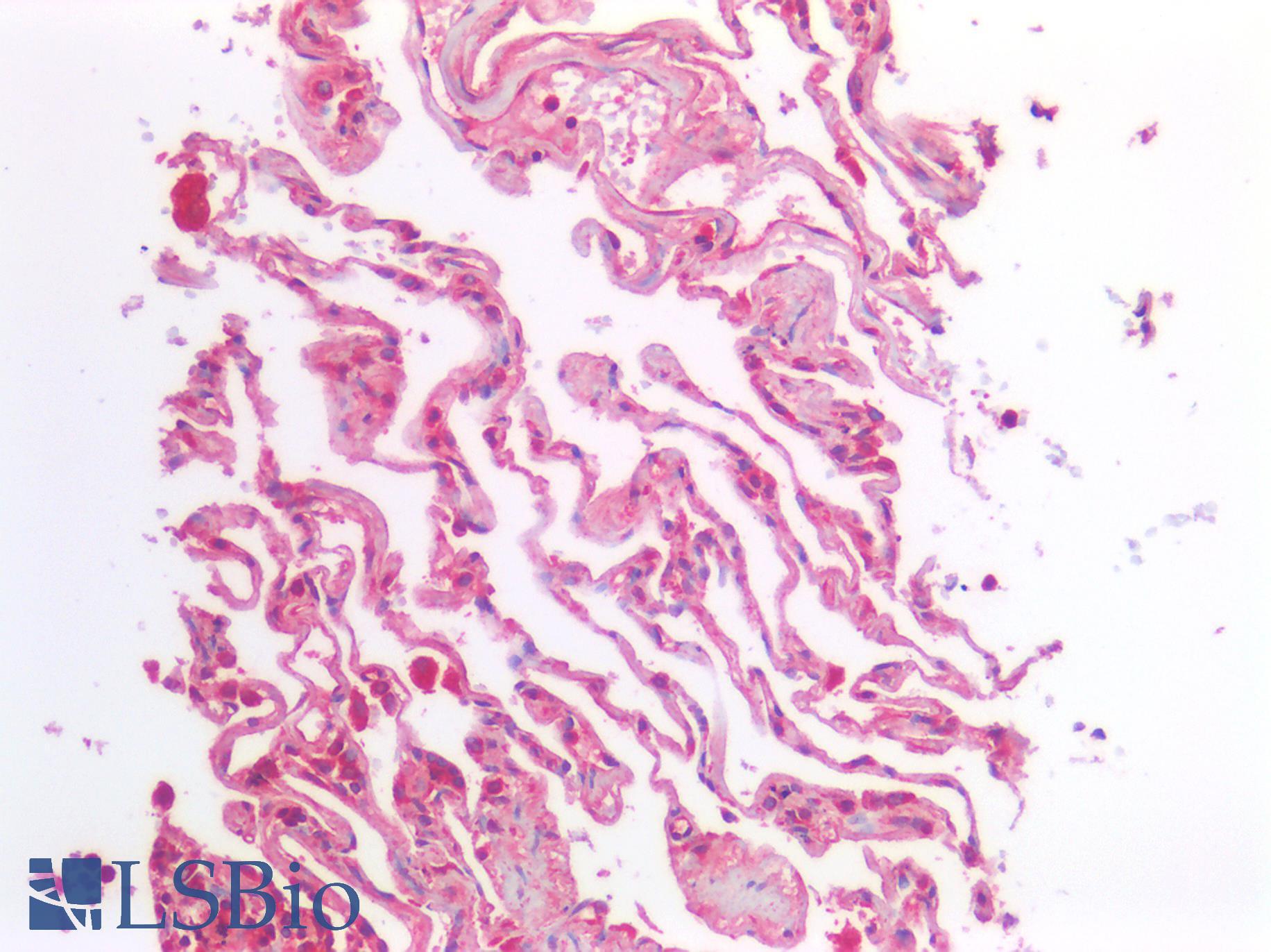 GAD1 / GAD67 Antibody - Human Lung: Formalin-Fixed, Paraffin-Embedded (FFPE)