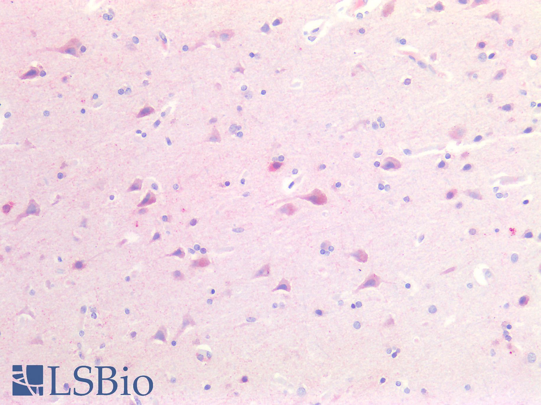 GAD65 Antibody - Human Brain, Cortex: Formalin-Fixed, Paraffin-Embedded (FFPE)