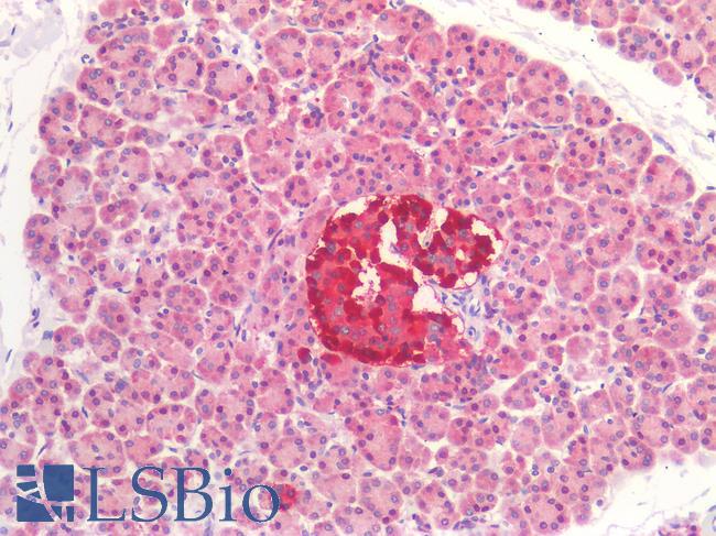 GAD65 Antibody - Human Pancreas: Formalin-Fixed, Paraffin-Embedded (FFPE)