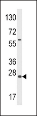 GADD45A / GADD45 Antibody - Western blot of anti-GADD45A Antibody in Y79 cell line lysates (35 ug/lane). GADD45A (arrow) was detected using the purified antibody.