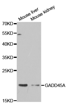 GADD45A / GADD45 Antibody - Western blot analysis of extracts of various cell lines, using GADD45A antibody.