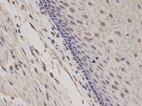 GADD45A / GADD45 Antibody - Immunohistochemistry of paraffin-embedded human esophagus using GADD45A antibody at dilution of 1:100 (400x lens).