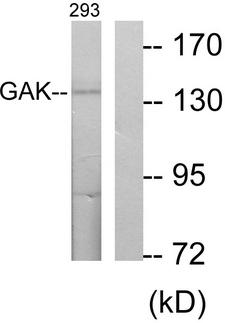 GAK Antibody - Western blot analysis of lysates from 293 cells, using GAK Antibody. The lane on the right is blocked with the synthesized peptide.