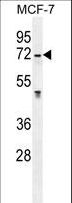 GALNS / Chondroitinase Antibody - GALNS Antibody western blot of MCF-7 cell line lysates (35 ug/lane). The GALNS antibody detected the GALNS protein (arrow).