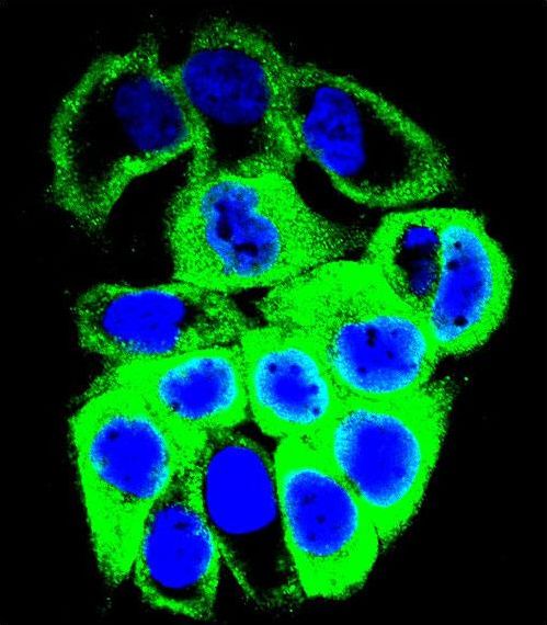 GALNS / Chondroitinase Antibody - Confocal immunofluorescence of GALNS Antibody with MCF-7 cell followed by Alexa Fluor 488-conjugated goat anti-rabbit lgG (green). DAPI was used to stain the cell nuclear (blue).