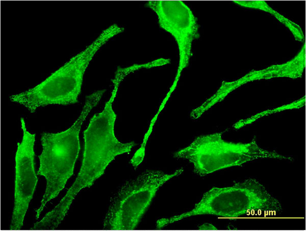 GALNT1 Antibody - Immunofluorescence of monoclonal antibody to GALNT1 on HeLa cell . [antibody concentration 10 ug/ml]