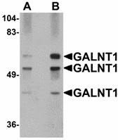 GALNT10 Antibody - Western blot of GALNT10 in rat brain tissue lysate with GALNT10 antibody at (A) 1 and (B) 2 ug/ml.
