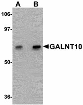 GALNT10 Antibody - Western blot of GALNT10 in SK-N-SH cell lysate with GALNT10 antibody at (A) 1 and (B) 2 ug/ml. 