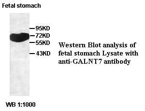 GALNT7 Antibody
