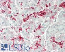 GALNT9 Antibody - Human Pancreas: Formalin-Fixed, Paraffin-Embedded (FFPE)