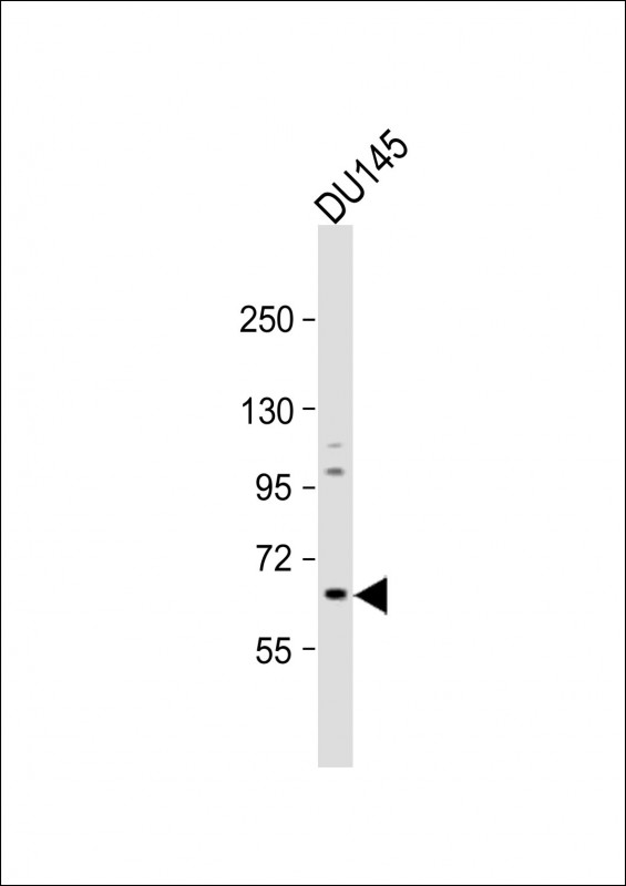 GALNT9 Antibody - Anti-GALNT9 Antibody at 1:1000 dilution + DU145 whole cell lysate Lysates/proteins at 20 µg per lane.