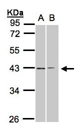 GALR2 / Galanin Receptor 2 Antibody - Sample(30 ug whole cell lysate). A:293T. B: H1299. 10% SDS PAGE. GALR2 antibody diluted at 1:1000.