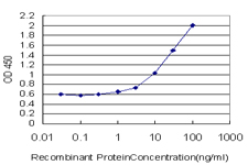 GALT Antibody - Detection limit for recombinant GST tagged GALT is approximately 0.3 ng/ml as a capture antibody.
