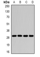 GAMT Antibody - Western blot analysis of GAMT expression in Jurkat (A); HeLa (B); mouse liver (C); rat brain (D) whole cell lysates.