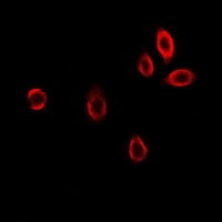 GAMT Antibody - Immunofluorescent analysis of GAMT staining in U2OS cells. Formalin-fixed cells were permeabilized with 0.1% Triton X-100 in TBS for 5-10 minutes and blocked with 3% BSA-PBS for 30 minutes at room temperature. Cells were probed with the primary antibody in 3% BSA-PBS and incubated overnight at 4 deg C in a humidified chamber. Cells were washed with PBST and incubated with a DyLight 594-conjugated secondary antibody (red) in PBS at room temperature in the dark.