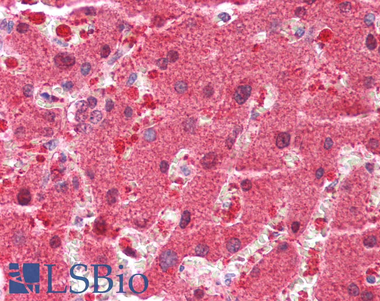 GAMT Antibody - Human Liver: Formalin-Fixed, Paraffin-Embedded (FFPE)