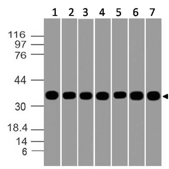 GAPDH Antibody - Fig-8: Western blot analysis of GAPDH. Anti-GAPDH antibody was used at 1 µg/ml on (1) PC3, (2) A549, (3)THP1, (4) Ramos, (5) HCT-116, (6) Raji and (7) MOLT-4 lysates.