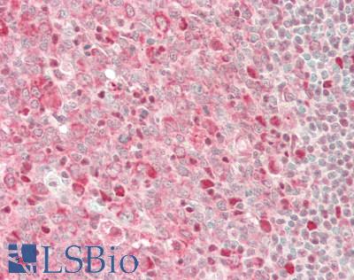 GAPDH Antibody - Human Tonsil: Formalin-Fixed, Paraffin-Embedded (FFPE)