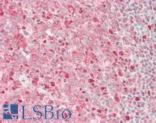 GAPDH Antibody - Human Tonsil: Formalin-Fixed, Paraffin-Embedded (FFPE)