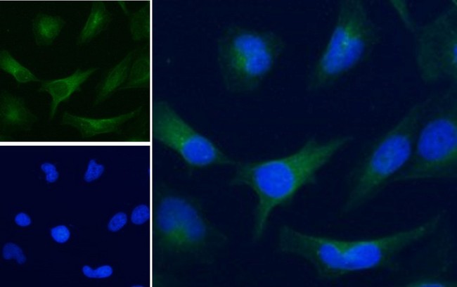 GAPDH Antibody - GAPDH antibody immunofluorescence analysis of paraformaldehyde fixed HeLa cells, permeabilized with 0.15% Triton. Primary incubation 1hr (5ug/ml) followed by Alexa Fluor 488 secondary antibody (1ug/ml), showing cytoplasmic staining. The nuclear stain is DAPI (blue). Negative control: Unimmunized goat IgG (10ug/ml) followed by Alexa Fluor 488 secondary antibody (2ug/ml).