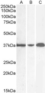 GAPDH Antibody - GAPDH antibody (0.01µg/ml) staining of Mouse Spleen (A), (0.1ug/ml) Rat Brain (B) and (0.5ug/ml) Rat Spleen (C) (35µg protein in RIPA buffer). Detected by chemiluminescence.