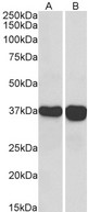 GAPDH Antibody - GAPDH antibody (0.1µg/ml) staining of Human Liver (A) and Tonsil (B) lysate (35µg protein in RIPA buffer). Primary incubation was 1 hour. Detected by chemiluminescence.