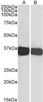 GAPDH Antibody - GAPDH antibody (0.1µg/ml) staining of lysates of cell line HEK293 (A) and HeLa (B) (35µg protein in RIPA buffer). Primary incubation was 1 hour. Detected by chemiluminescence.
