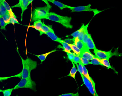 GAPDH Antibody - Human neuroblastoma SH-SY5Y cells stained with GAPDH antibody (green), chicken antibody to neurofilament NF-H CPCA-NF-H (red) and DNA (blue). The antibody reveals strong cytoplasmic staining for GAPDH.